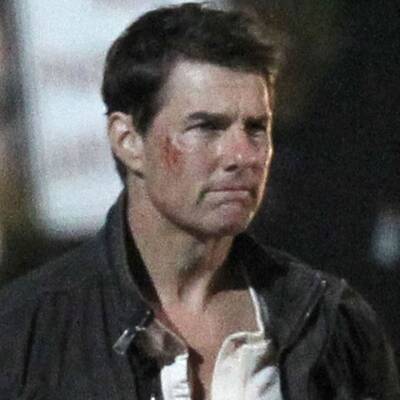 Tom Cruise mit böser Gesichtsverletzung