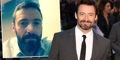 Hugh Jackman