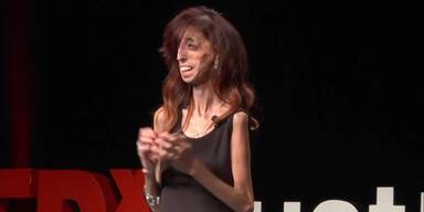 Lizzie Velasquez: "Wie man sich selbst definiert"
