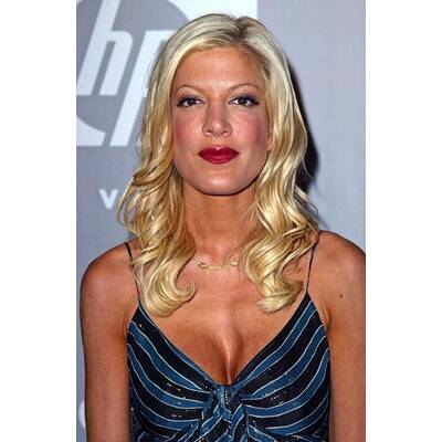 Tori Spelling: Vom Teenie-Star zum OP-Opfer