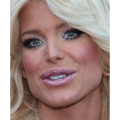 Stars in der Botox-Falle