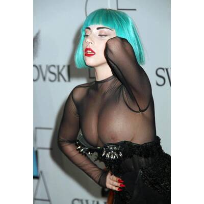 Lady Gaga: Trennung von ihrem Kleid