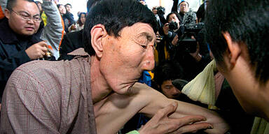 Mann mit längstem Arm der Welt rettet Delfine