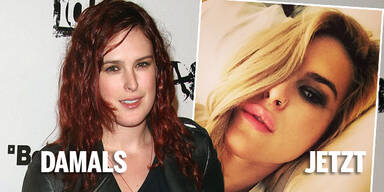 Rumer Willis: Neue Lippen