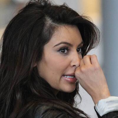 Kim Kardashian: Kahle Stelle am Kopf
