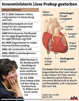 070101_aortariss liese prokop_APA