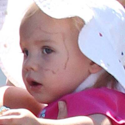 Auweh: Kleine Willow mit blauem Auge