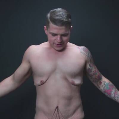 Haut nach 70 Kilo Gewichtsverlust