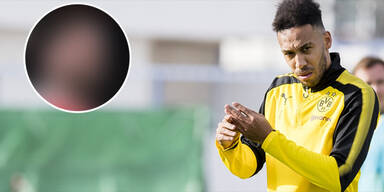 Aubameyang