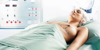 Schönheits-OPs erst ab 16