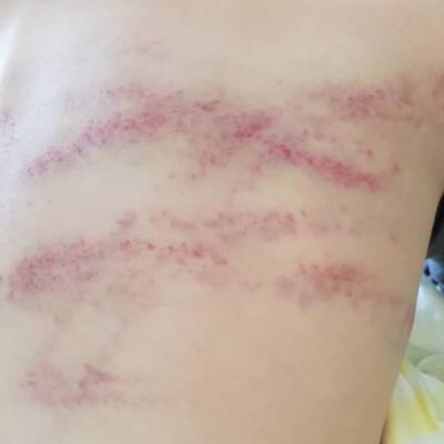 Rassismus-Attacke auf Brüder