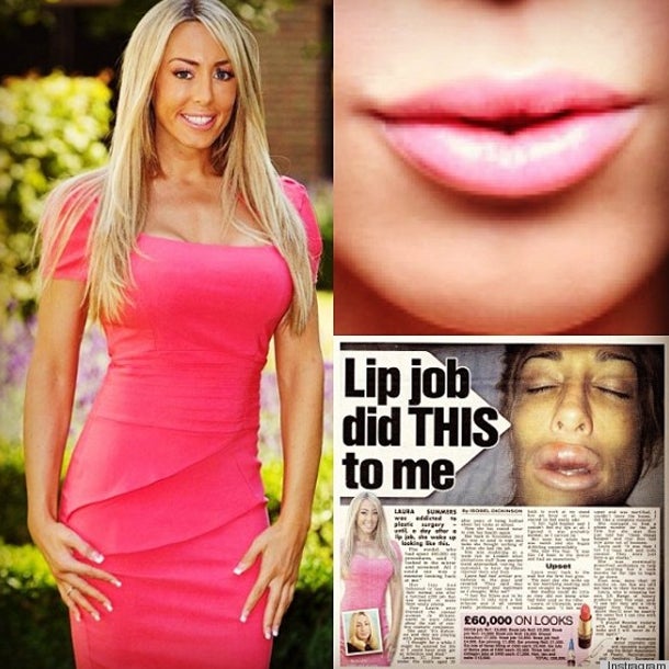 Sie wurde zum Monster entstellt