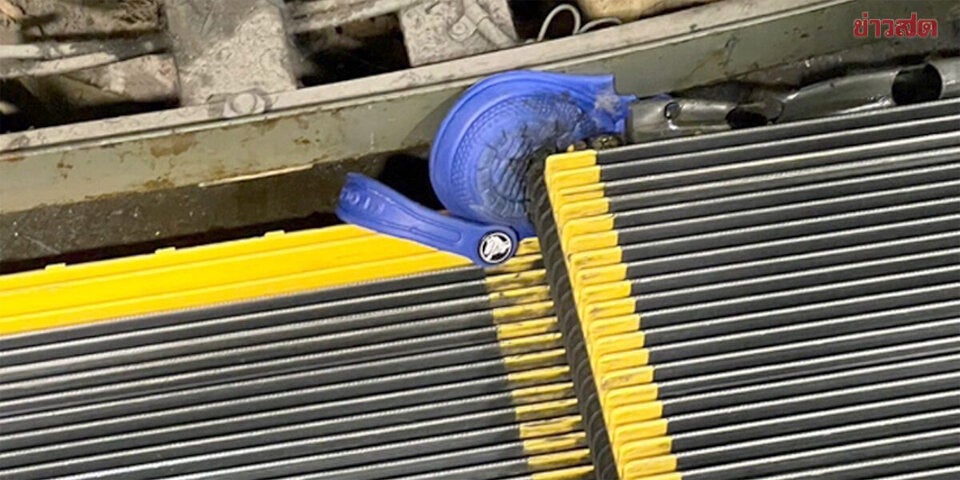 Frau stürzt am Laufband - Bein amputiert