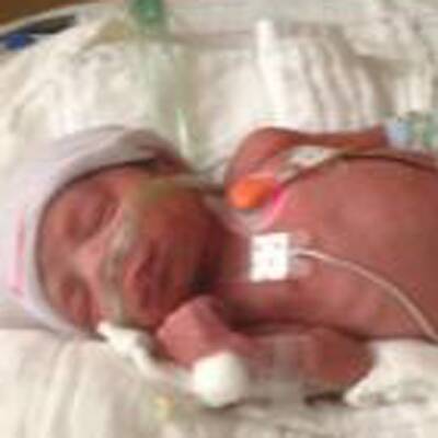 Die Vierlinge müssen medizinisch überwacht werden. 