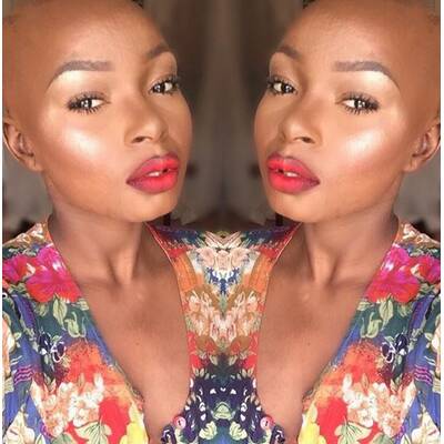 Brandopfer macht anderen Mut