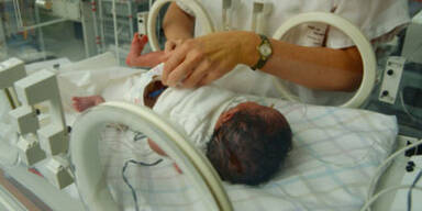 Zustand der Babys ist stabil