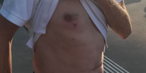 Demo Favoriten Verletzter