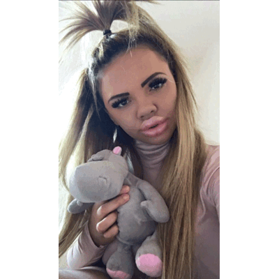 BigLipKayla - Über ihren Look spottet das Web 