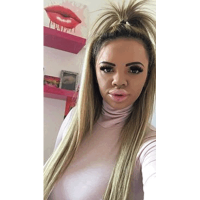 BigLipKayla - Über ihren Look spottet das Web 