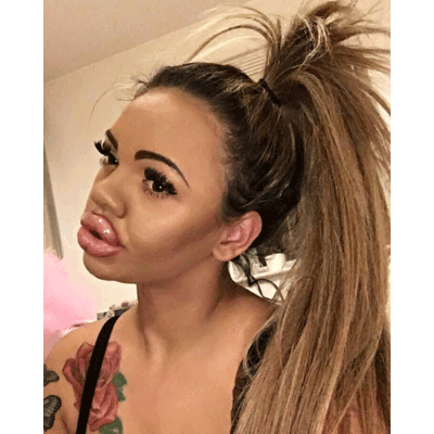 BigLipKayla - Über ihren Look spottet das Web 