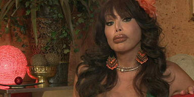 Behindert durch zu viele Schönheits-OPs 