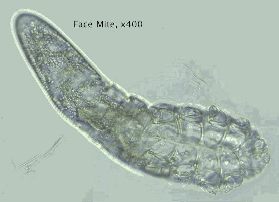 Mites
