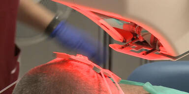 Haartransplantation mit Roboter