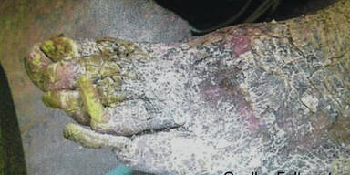 Verwahrloster H&auml;ftling ist Dirnenw&uuml;rger von Z&uuml;rich