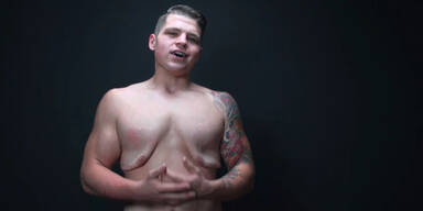 Haut schlafft nach Gewichtsverlust