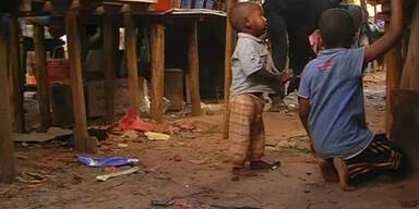 Pest auf Madagaskar best&auml;tigt