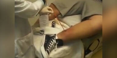 Bandwurm aus Bein entfernt