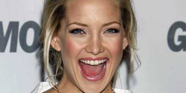 Cheese! So kriegen Sie das Hollywoodl&auml;cheln