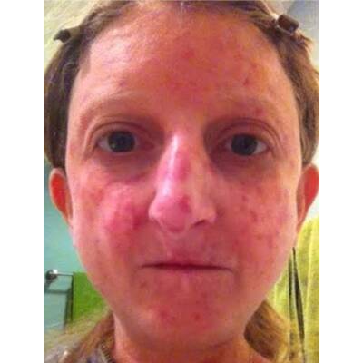 Diese mutigen Frauen stehen zu ihrer Haut