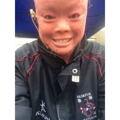 Diese mutigen Frauen stehen zu ihrer Haut