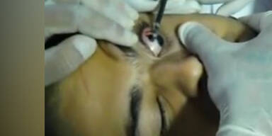 Rapper l&auml;sst sich Auge t&auml;towieren