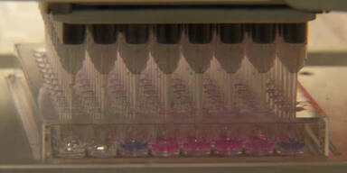 Superantibiotikum im Erdboden entdeckt