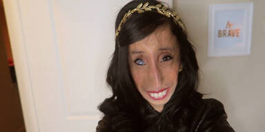 Schwerkranke Frau wehrt sich gegen Mobbing