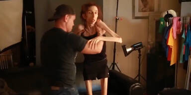 Frau wiegt nur noch 20 Kilo