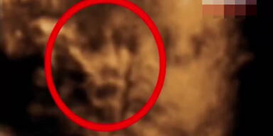 ‚Geist‘ erscheint bei Ultraschall-Untersuchung