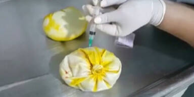 KOKS in Brust- Implantaten
