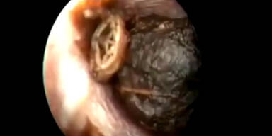 160223_InsektImOhr.Standbild001 - Kopie.jpg