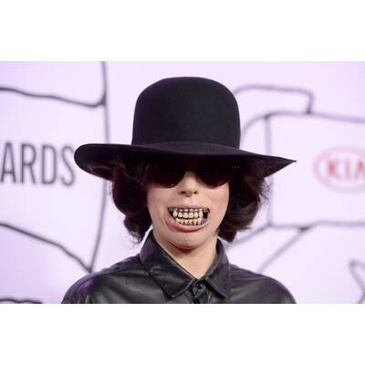 Lady Gaga mit bizzarem Gebiss