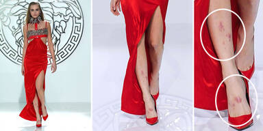 Droht Cara Delevingne das Karriere-Aus?