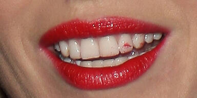 Lippenstift-Patzer: Wem gehört der Mund?