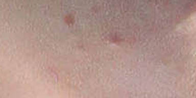 Wem gehört dieses Pickelgesicht?