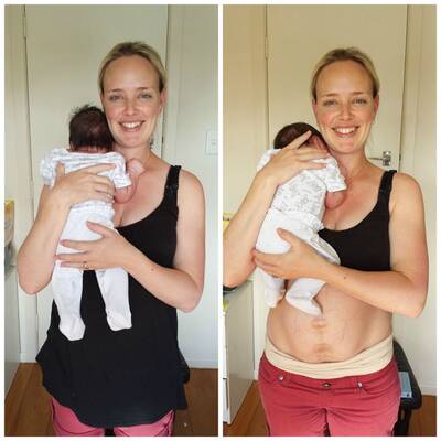 So sieht ein After-Baby-Body wirklich aus