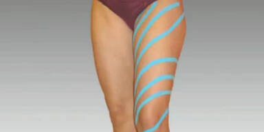 &bdquo;Taping&ldquo; in der Sportmedizin