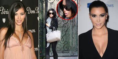 Kim Kardashian: Das hat sie alles machen lassen