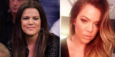 Khloe Kardashian: War sie etwa beim Beauty-Doc?