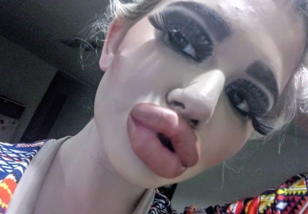 SIE hat die dicksten Lippen der Welt